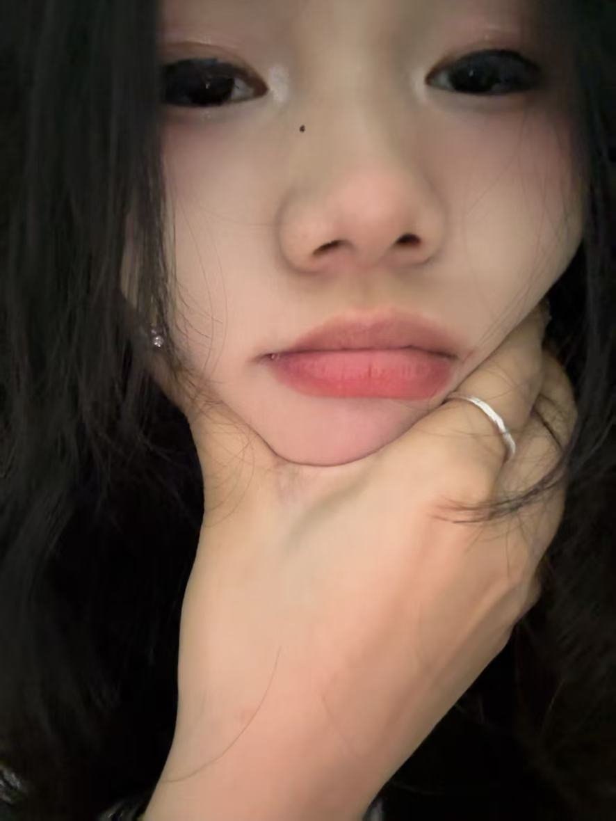 E332