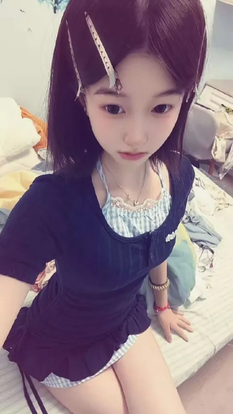 E417